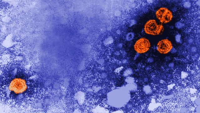  Viel mehr Hepatitis-Infizierte in der Schweiz als angenommen