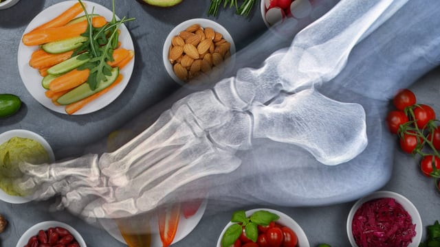  Ist vegane Ernährung schlecht für die Knochen?