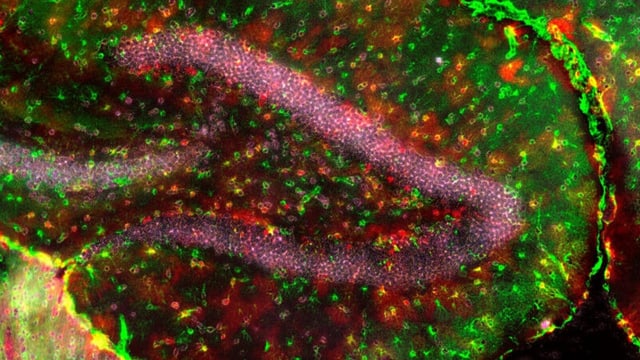  Multitaskende Hirnzellen: Schweizer Forscher finden neuen Zelltyp