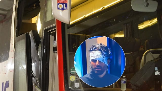  Lyon-Bus mit Steinen beworfen – Trainer Grosso verletzt